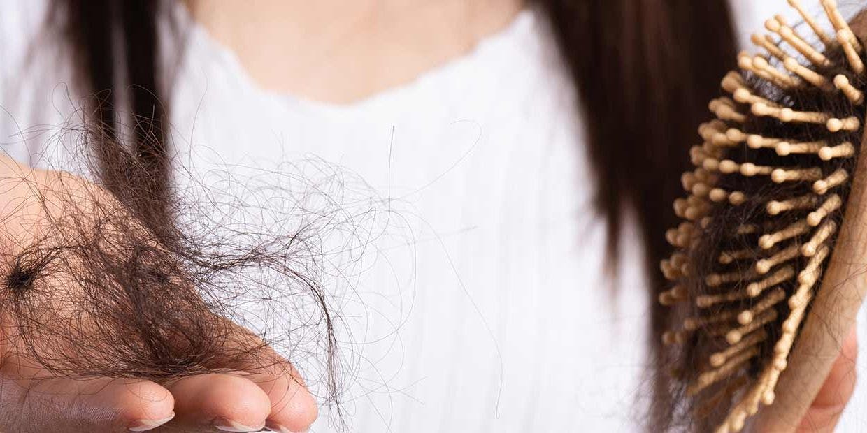 Cover Image for Queda de cabelo na mulher — tipos, causas e tratamentos