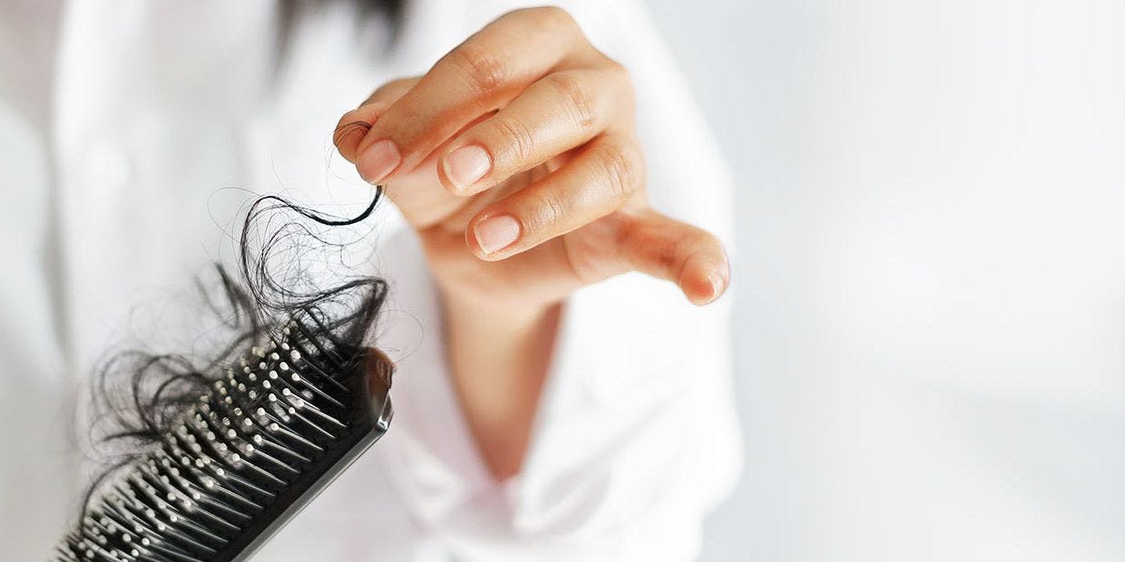 Cover Image for Conheça os 4 principais tipos de queda de cabelo, quais as suas características e como podem  ser tratados